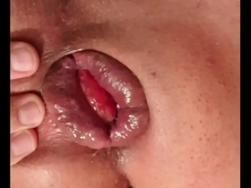 Gay prolapse fisting video